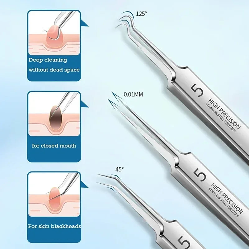 Blackhead Clip Tweezers